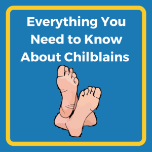 Everything You Need to Know About Chilblains