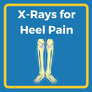 X-rays for heel pain