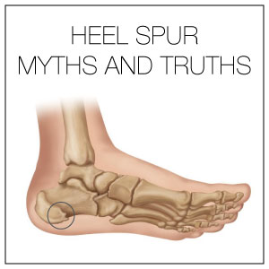 7 Heel Spur Myths and Facts | Heel That 