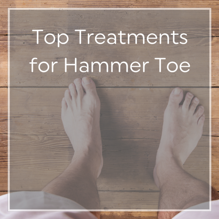 Top Treatments for Hammer Toe Heel That Pain