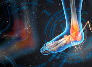 Heel Pain During Cancer | Heel That Pain