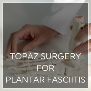 Topaz Surgery Plantar Fasciitis