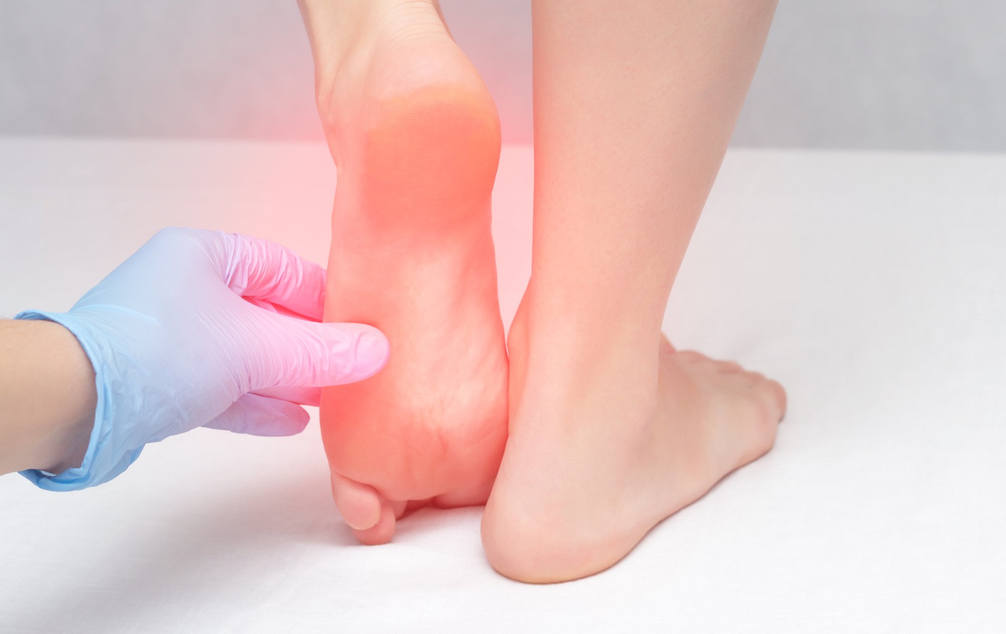 heel pain due to uric acid